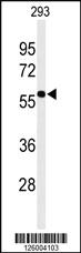 Anti-RPL23 Rabbit Polyclonal Antibody