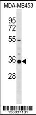 Anti-KCNA5 Rabbit Polyclonal Antibody