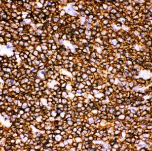 Anti-CD20 Polyclonal Antibody