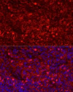 Anti-Ly6g antibody