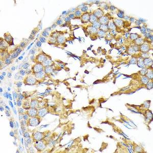 Immunohistochemistry analysis of paraffin-embedded rat testis using Anti-ALDH1A2 Antibody [ARC1797] (A307940) at a dilution of 1:100 (40X lens). Perform microwave antigen retrieval with 10 mM Tris/EDTA buffer pH 9.0 before commencing with IHC staining protocol