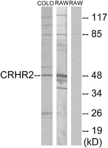 Anti-CRHR2 antibody