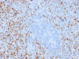 Immunohistochemical analysis of formalin-fixed, paraffin-embedded human spleen using Anti-Integrin beta 3 Antibody [ITGB3/2145]