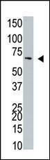 Anti-NUB1 Rabbit Polyclonal Antibody (FITC (Fluorescein))