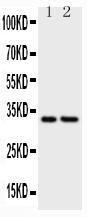 Anti-CD20 Polyclonal Antibody