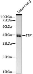 Western blot analysis of Mouse lung, using Anti-TTF1 Antibody [ARC51284] (A306550) at 1:2000 dilution