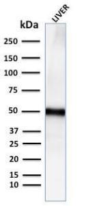 Western blot analysis of human liver tissue lysate using Anti-Adipophilin Antibody [ADFP/2755R]