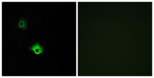 Anti-GALR3 antibody