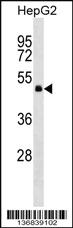 Anti-GNA13 Rabbit Polyclonal Antibody