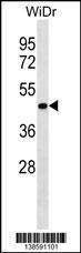 Anti-ERLIN2 Rabbit Polyclonal Antibody (HRP (Horseradish Peroxidase))