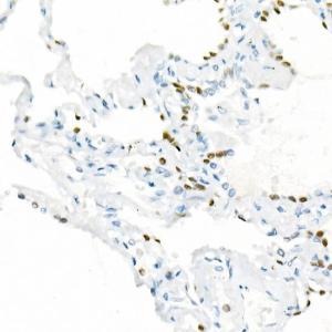 Immunohistochemistry analysis of paraffin-embedded human lung using Anti-TTF1 Antibody [ARC51284] (A306550) at a dilution of 1:1000 (40x lens)