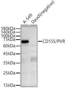 Western blot analysis of variou