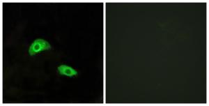 Immunofluorescence analysis of HeLa cells using Anti-GPR174 Antibody. The right hand panel represents a negative control, where the antibody was pre-incubated with the immunising peptide