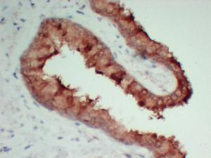 Immunohistochemical analysis of paraffin-embedded human Prostate-high magnification using Anti-TIMP1 Antibody