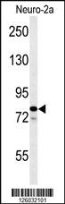 Anti-F91A1 Rabbit Polyclonal Antibody