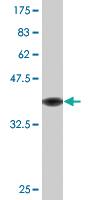 Anti-SORD Mouse Monoclonal Antibody [clone: 2B8]