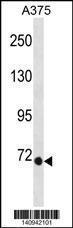 Anti-EOMES Rabbit Polyclonal Antibody (Biotin)