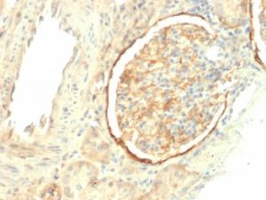 Immunohistochemical analysis of formalin-fixed, paraffin-embedded human kidney using Anti-Integrin beta 3 Antibody [ITGB3/2145]