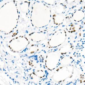 Immunohistochemistry analysis of paraffin-embedded human thyroid using Anti-TTF1 Antibody [ARC51284] (A306550) at a dilution of 1:1000 (40x lens)