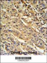 Anti-F91A1 Rabbit Polyclonal Antibody