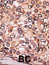 Anti-MAGEA2 Rabbit Polyclonal Antibody (AP (Alkaline Phosphatase))