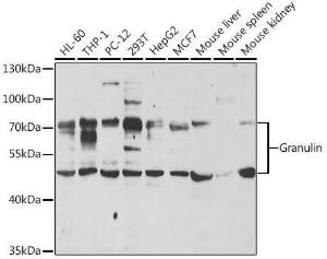 Antibody anti-GRN 100 µl