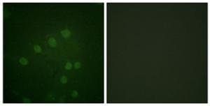 Immunofluorescence analysis of HepG2 cells using Anti-AurB (phospho Thr232) Antibody. The right hand panel represents a negative control, where the antibody was pre-incubated with the immunising peptide