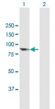 Anti-PCIF1 Mouse Polyclonal Antibody