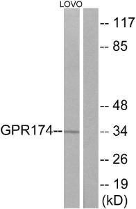 Western blot analysis of lysates from LOVO cells using Anti-GPR174 Antibody. The right hand lane represents a negative control, where the antibody is blocked by the immunising peptide