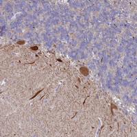 Anti-WDR76 Rabbit Polyclonal Antibody