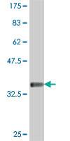 Anti-PLA2G3 Mouse Polyclonal Antibody