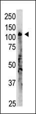 Anti-OAS3 Rabbit Polyclonal Antibody (Biotin)