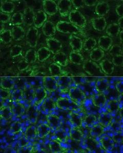 Anti-TBCE antibody