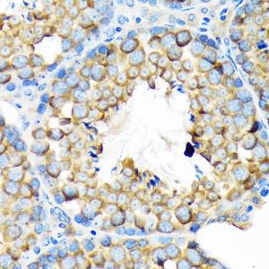 Immunohistochemistry analysis of paraffin-embedded mouse testis using Anti-ALDH1A2 Antibody [ARC1797] (A307940) at a dilution of 1:100 (40X lens). Perform microwave antigen retrieval with 10 mM Tris/EDTA buffer pH 9.0 before commencing with IHC staining protocol