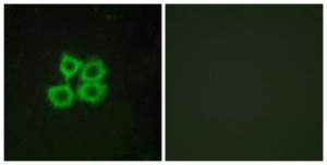 Anti-CRHR2 antibody