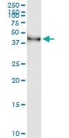 Anti-ORC4 Polyclonal Antibody Pair