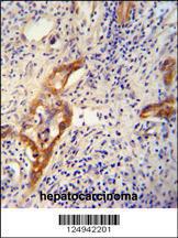 Anti-CLPX Rabbit Polyclonal Antibody