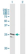 Anti-ARFRP1 Mouse Polyclonal Antibody