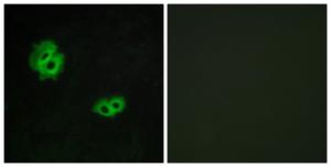 Immunofluorescence analysis of MCF7 cells using Anti-GPR171 Antibody. The right hand panel represents a negative control, where the antibody was pre-incubated with the immunising peptide