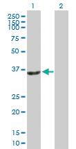 Anti-SIRT2 Mouse Polyclonal Antibody