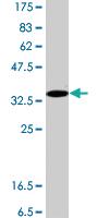 Anti-HYAL2 Mouse Polyclonal Antibody