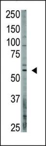 Anti-CREB3L1 Rabbit Polyclonal Antibody (AP (Alkaline Phosphatase))