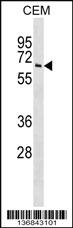 Anti-TPP1 Rabbit Polyclonal Antibody