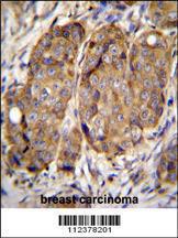 Anti-METTL2B Rabbit Polyclonal Antibody (FITC (Fluorescein Isothiocyanate))