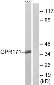 Western blot analysis of lysates from K562 cells using Anti-GPR171 Antibody. The right hand lane represents a negative control, where the antibody is blocked by the immunising peptide