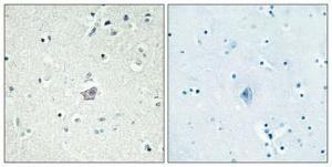 Anti-CRHR2 antibody