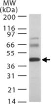 Anti-HTRA3 Rabbit Polyclonal Antibody