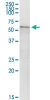 Anti-CA9 Polyclonal Antibody Pair