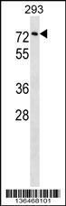 Anti-CPNE3 Rabbit Polyclonal Antibody (AP (Alkaline Phosphatase))