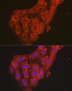 Antibody anti-CXCL1 100 µl